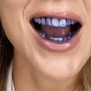 SmileKit|  Tandblegemiddel